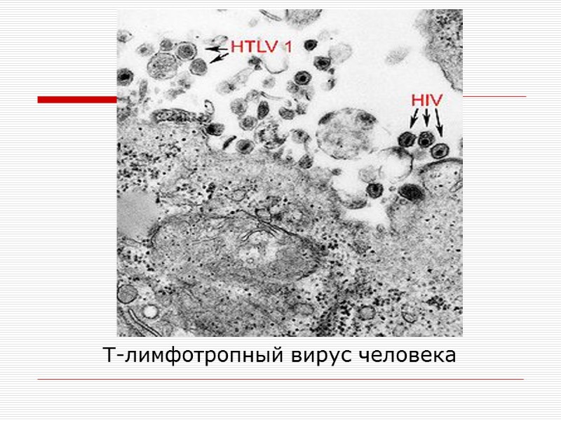 Т-лимфотропный вирус человека